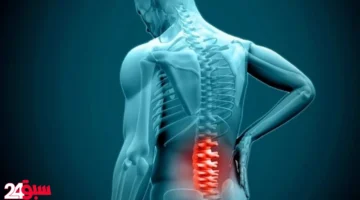 الديسك.. أعراض مبكرة لا تتجاهلها وطرق بسيطة للوقاية من آلامه المبرحة